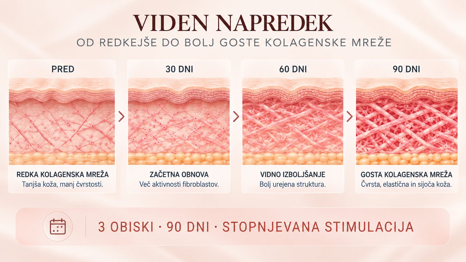 Viden napredek: od redkejše do bolj goste kolagenske mreže (pred · 30 · 60 · 90 dni)